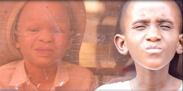 documental africanos albinos
